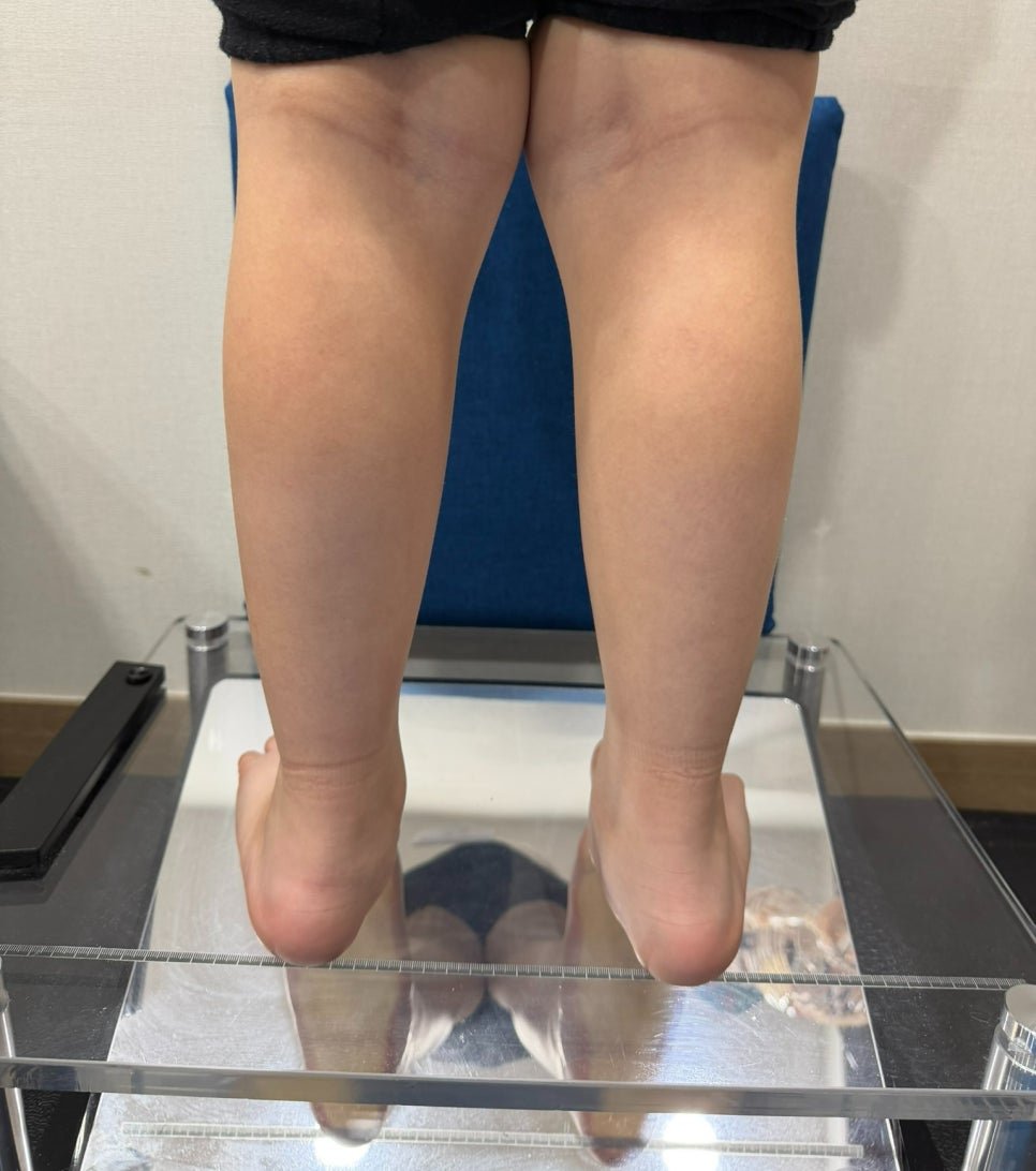 소아 평발, 집에서 30초 만에 확인하는 2가지 체크법
