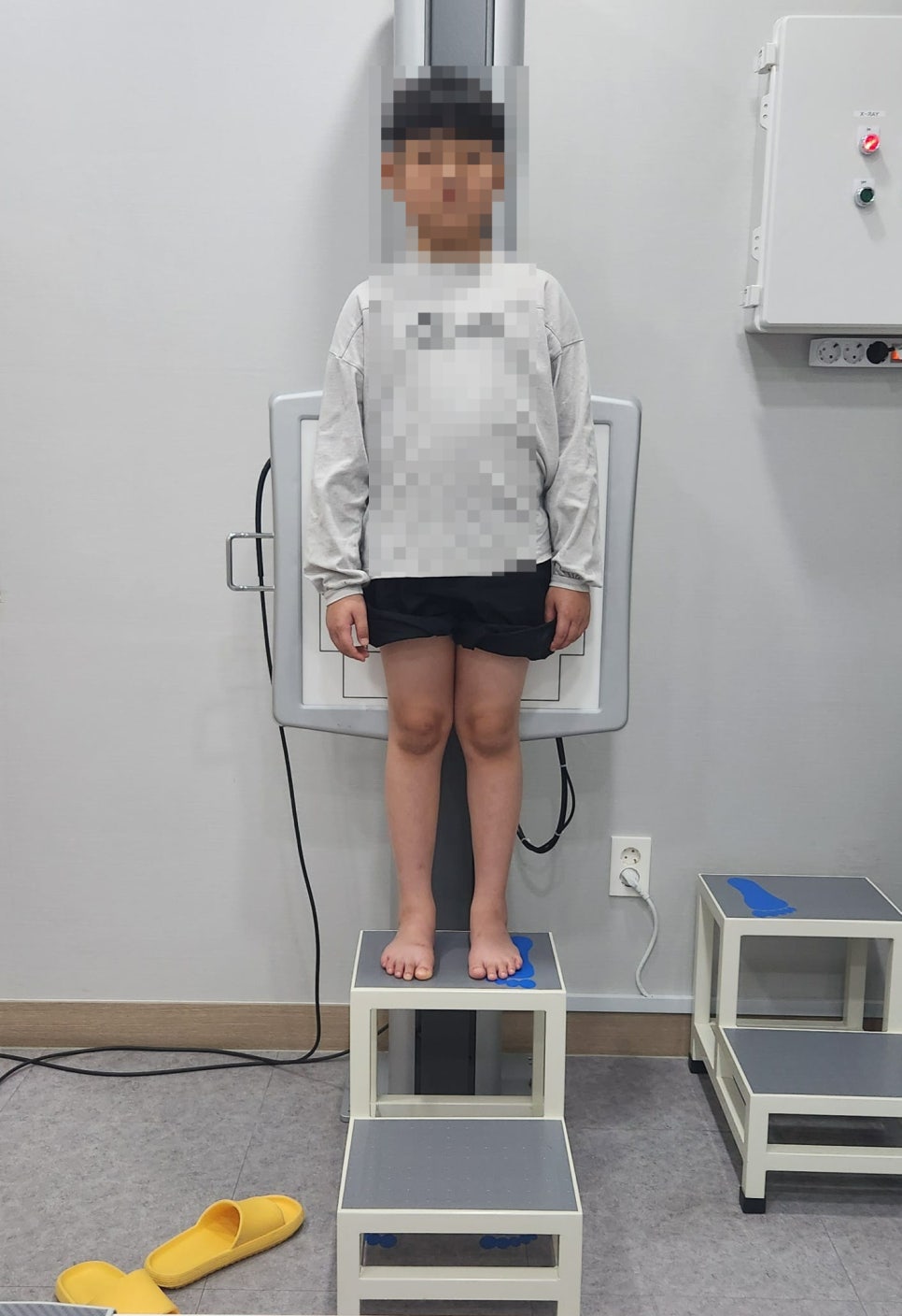아이 평발, 치료해야 할 경우는? 꼭 확인해야 할 4가지