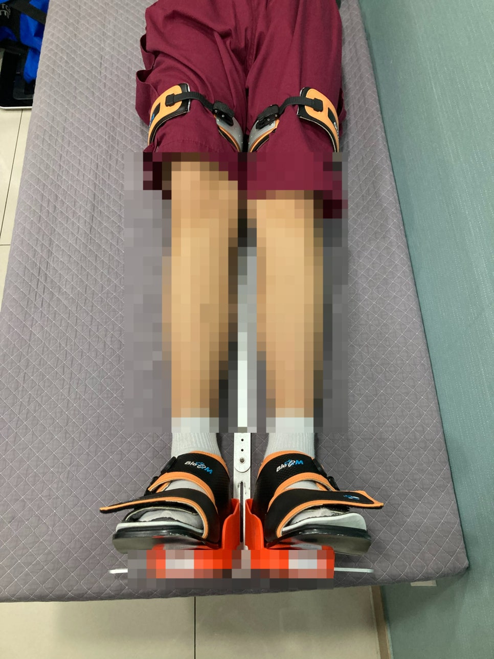발레를 하면 안짱다리가 좋아지나요?