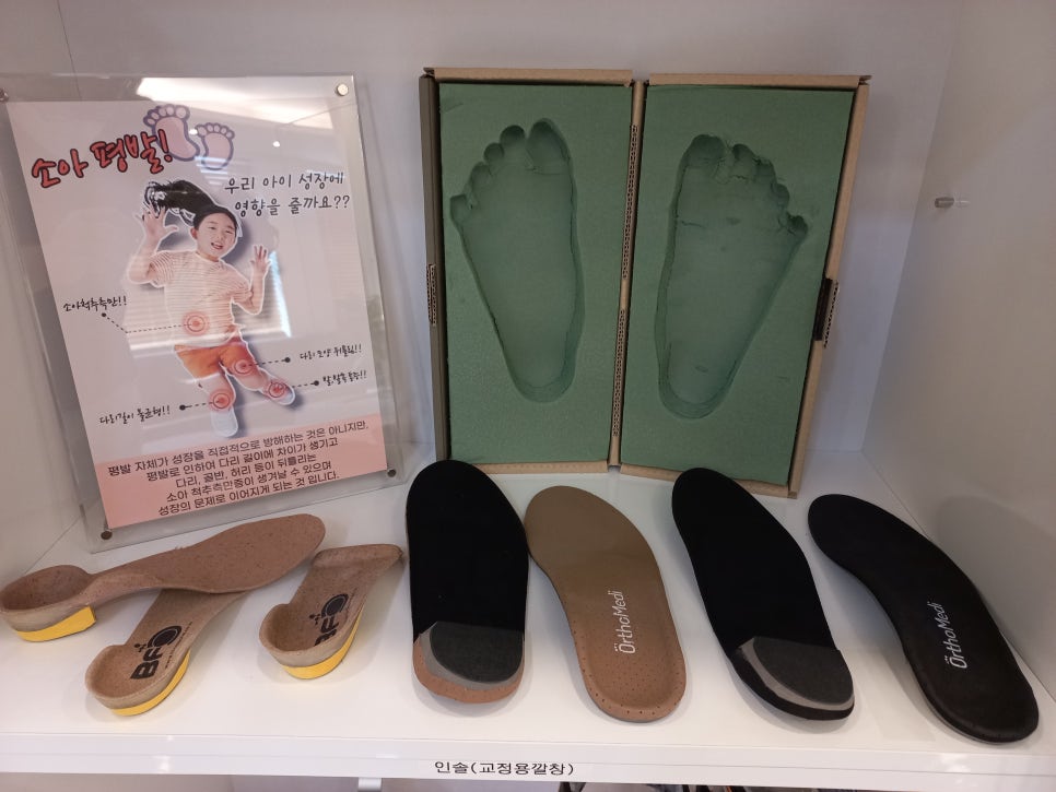 소아 평발 진료 모습