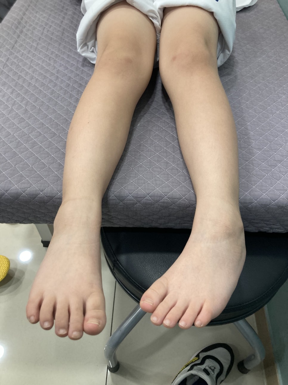 맞춤형 깔창과 교정장치