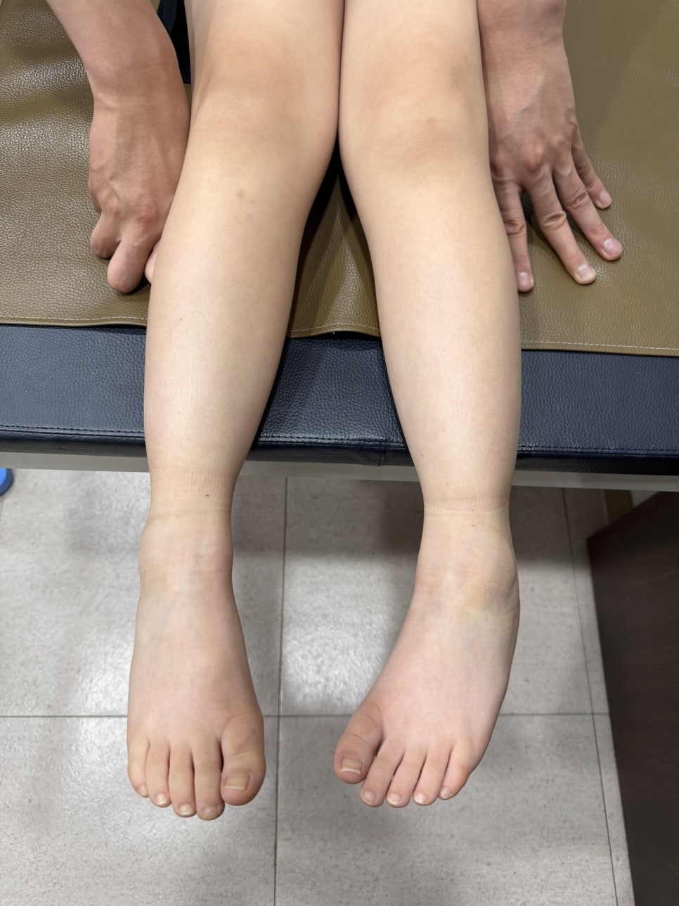 맞춤형 깔창과 교정장치