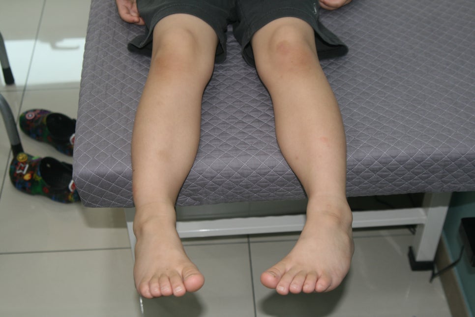 진료실에서 다리 정렬을 확인하는 아이