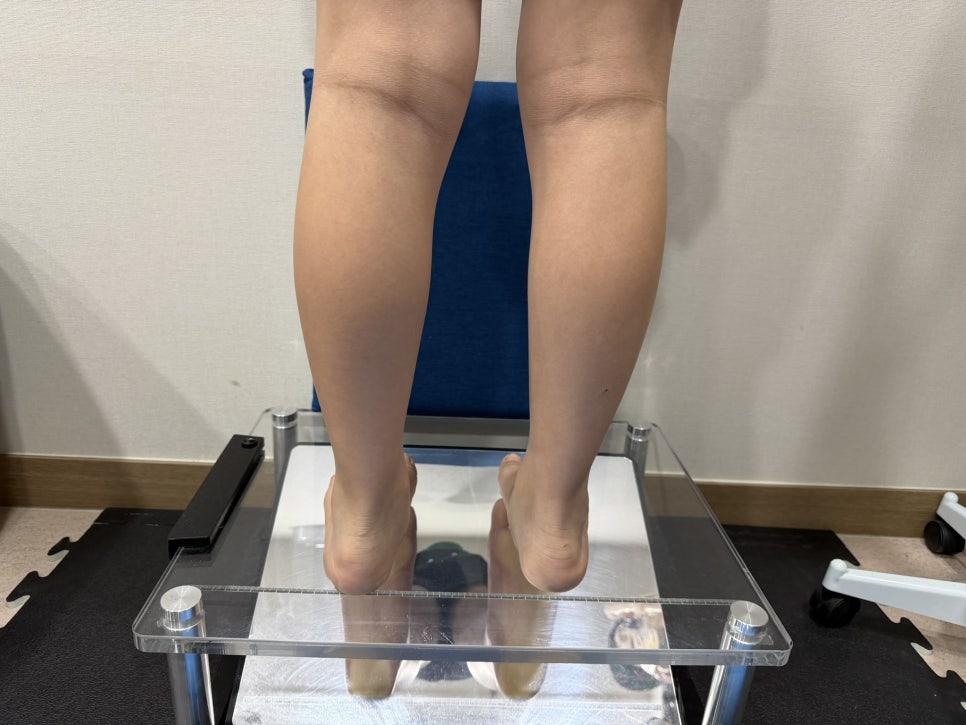 맞춤형 깔창과 의료용 교정기